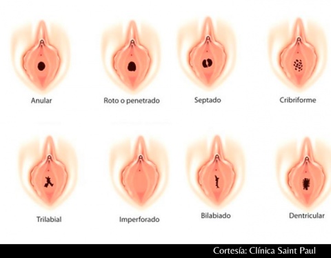 VIRGINIDAD EN LAS MUJERES virginidad en las mujeres: